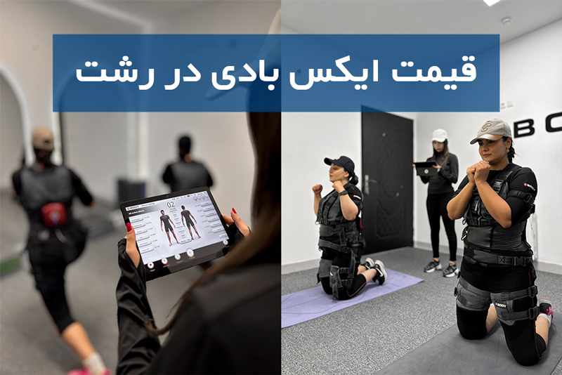 هزینه ایکس بادی در رشت